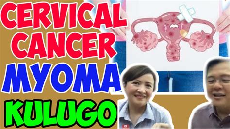 itsura ng vagina|Kulugo sa Ari (Genital Warts) .